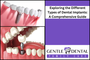 Exploring the Different Types of Dental Implants: A Comprehensive Guide