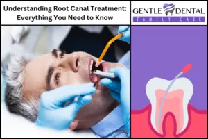 Understanding Root Canal Treatment: Everything You Need to Know