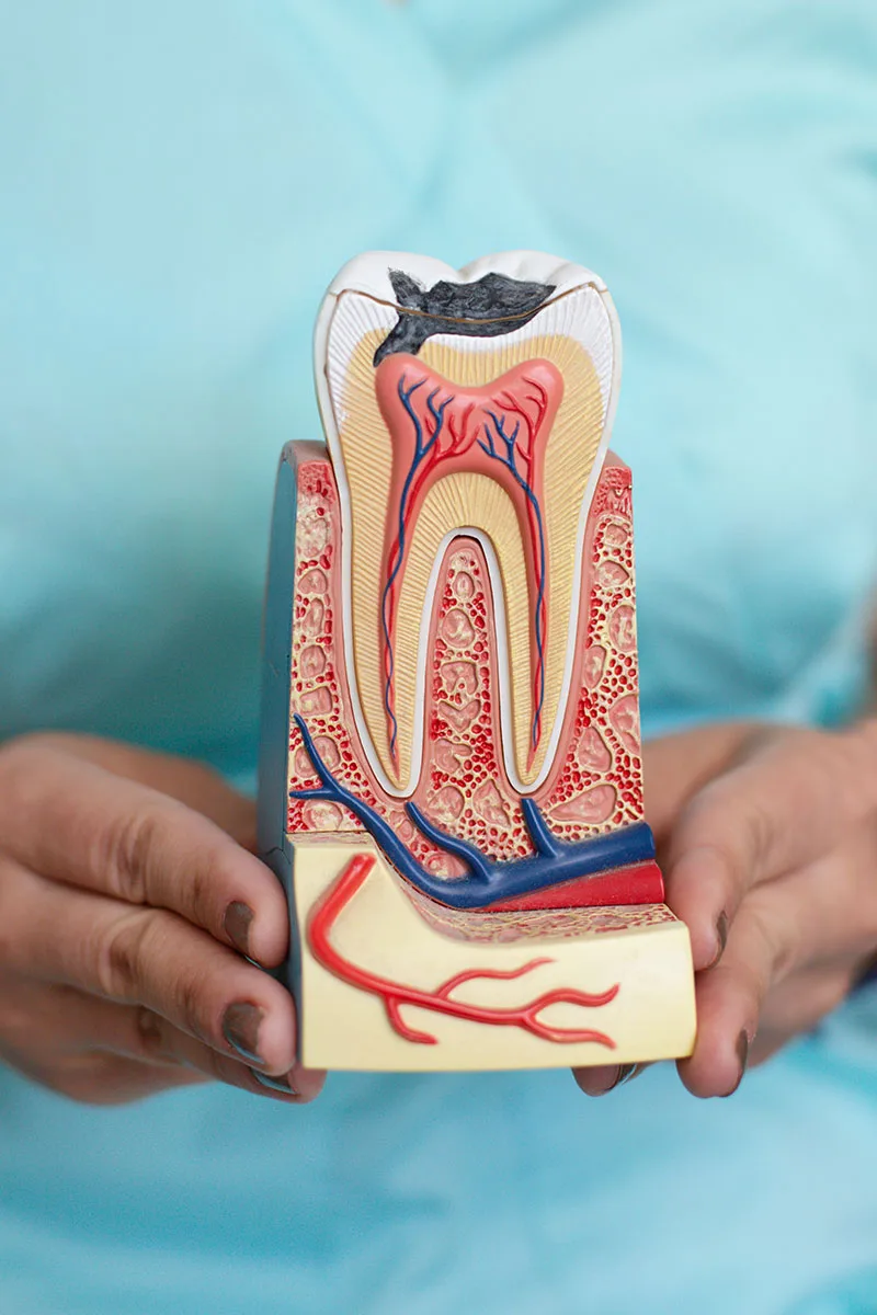 Root Canal procedure at Gentle Dental Family Care in Queens, NY.