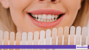 Translucent Teeth