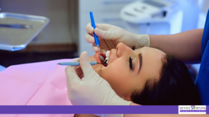 Front tooth cavity filling