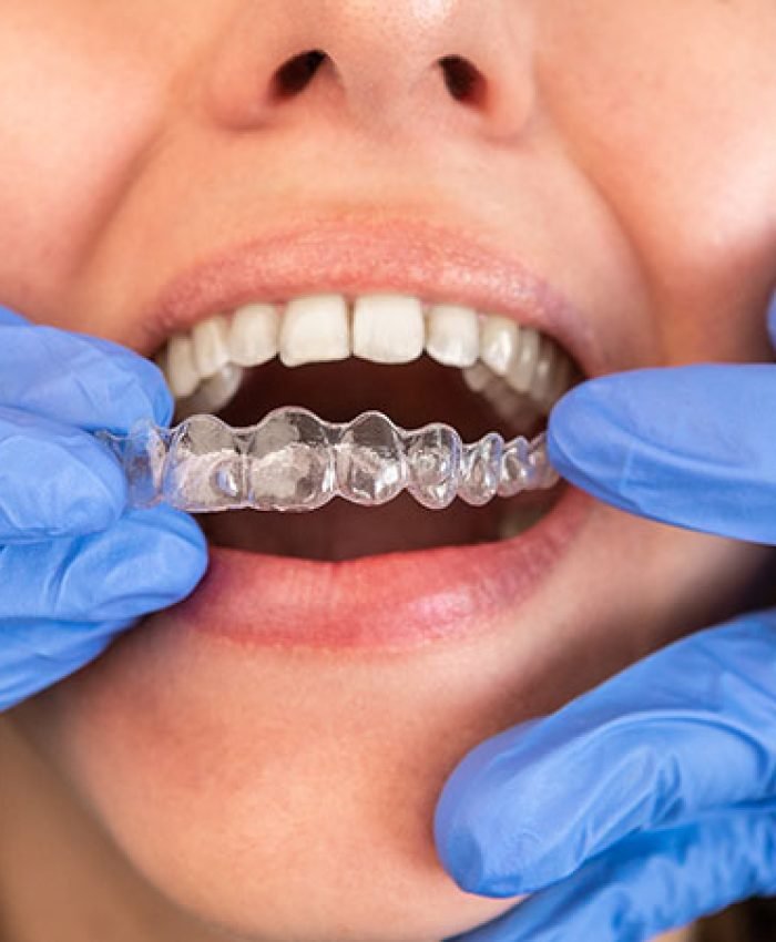 invisalign Expert local Invisalign dentist in Kew Gardens, NY | Gentle Dental Family Care